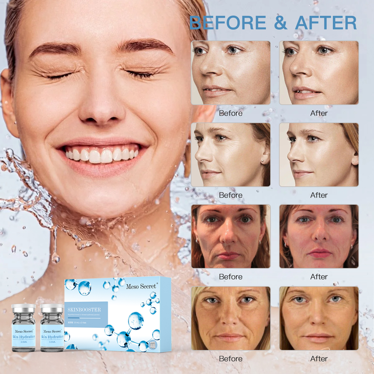 Meso Secret Injectable Skinbooster Skin Hydration