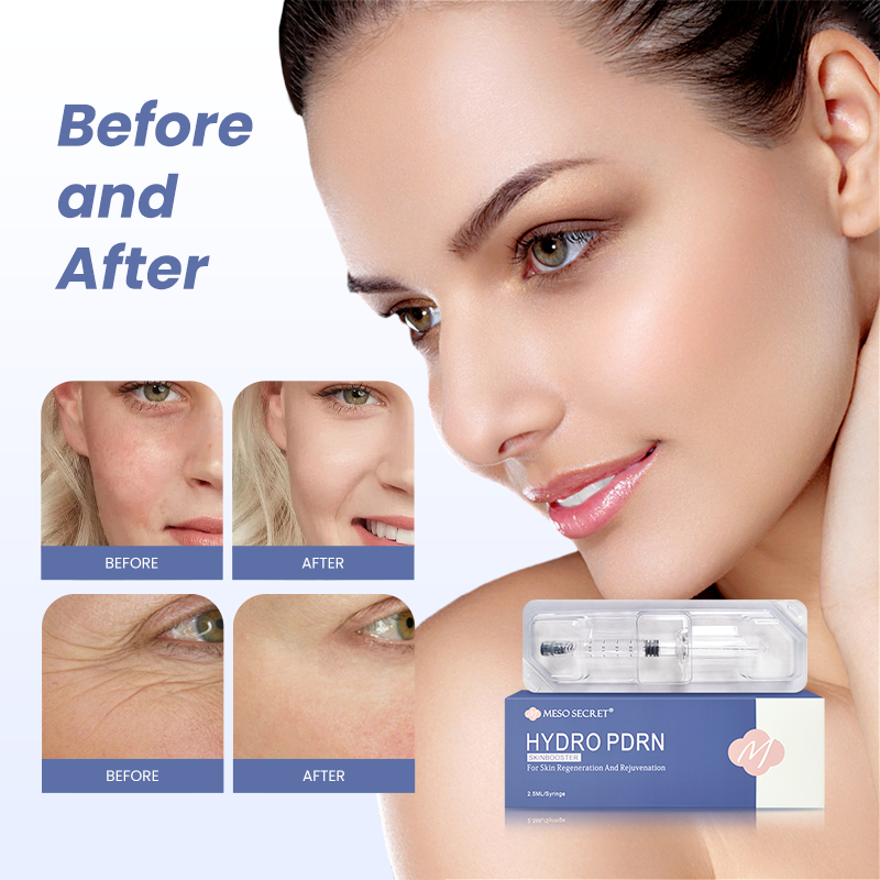 Hydro PDRN for Skin Regeneration and Rejuvenation