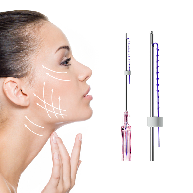 PDO Fish Bone Threads Cones Cog 19G 100MM